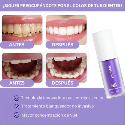 SmileKit V34™-Blanqueador de Dientes